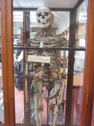 william-burke-skeleton.jpg